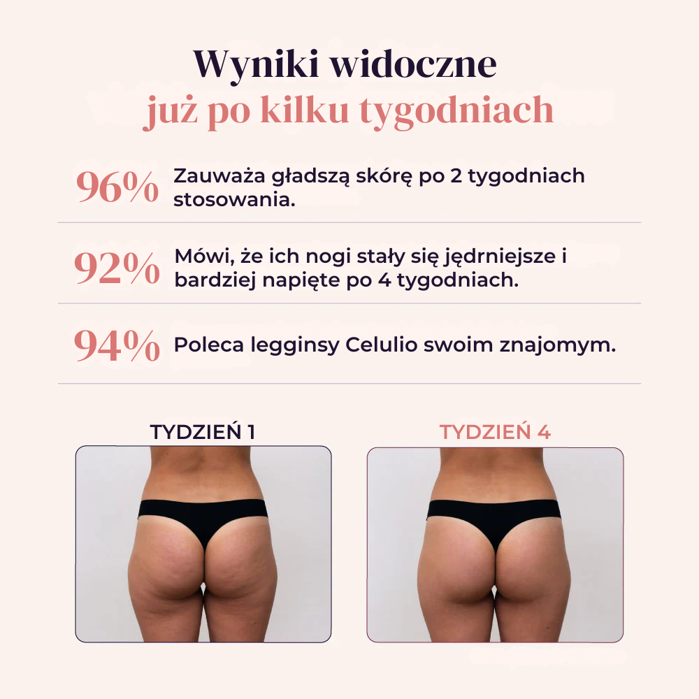 Modelujące Legginsy – Zmień swoją sylwetkę bez wysiłku